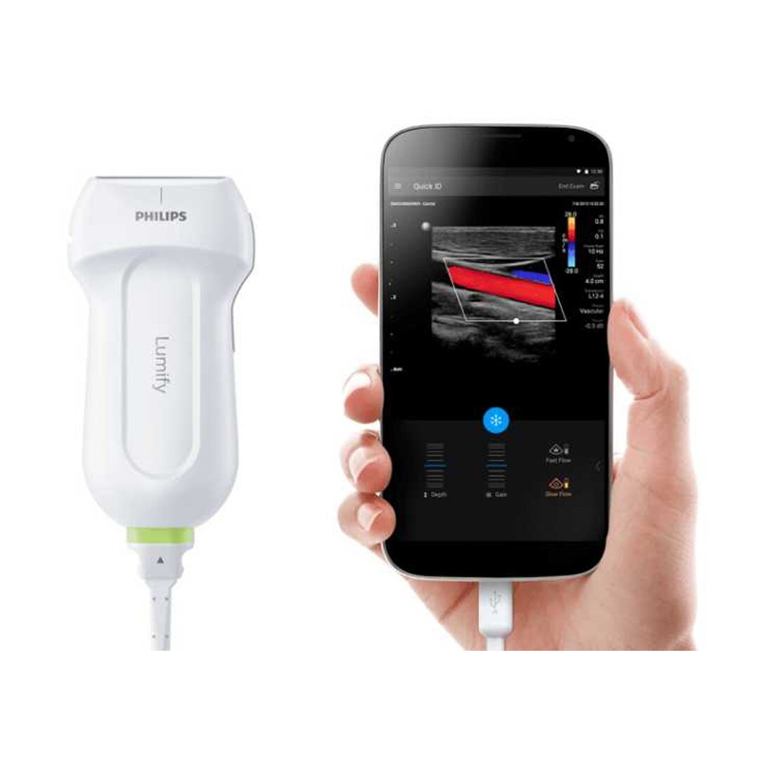 Philips Lumify
