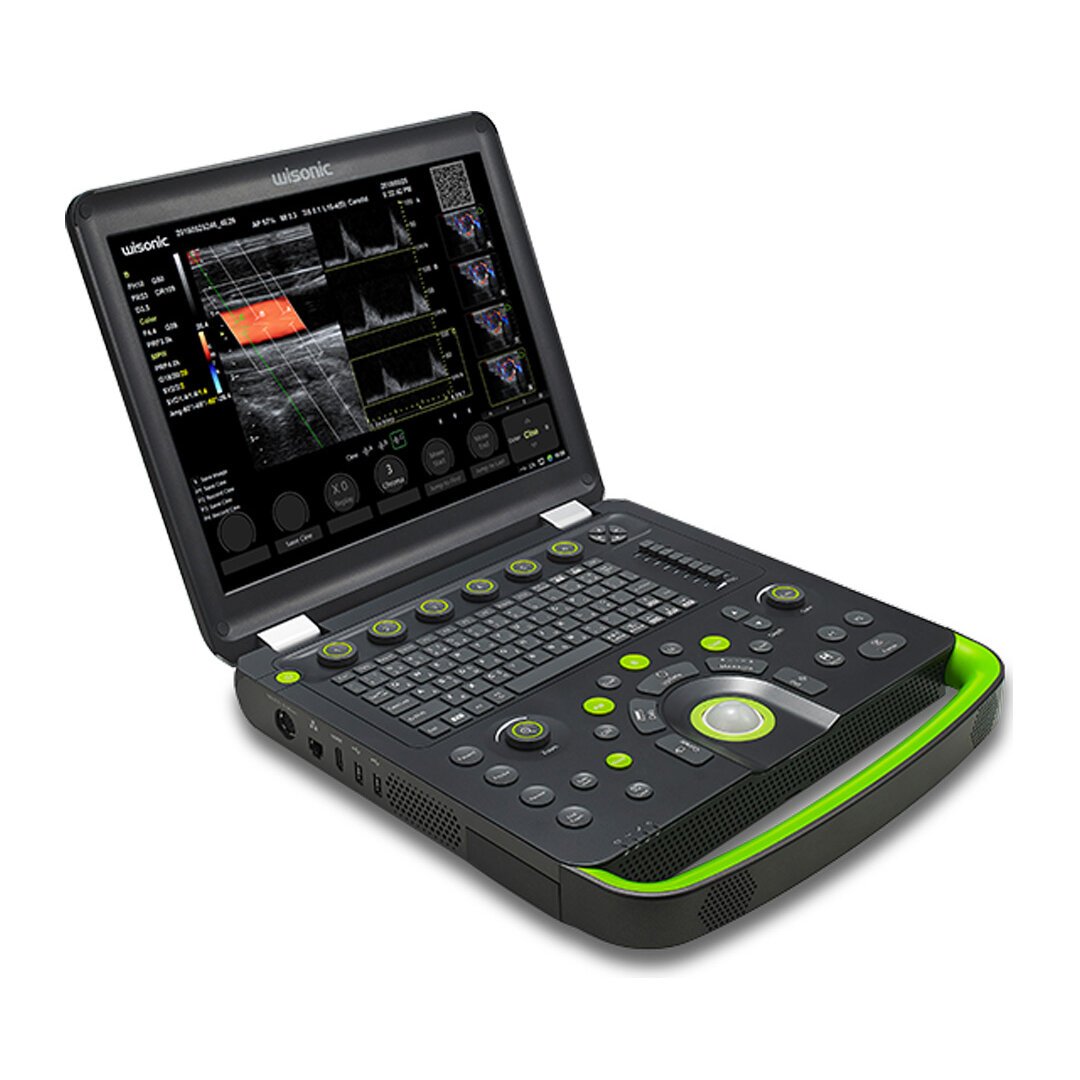 Clover Ultrasound System