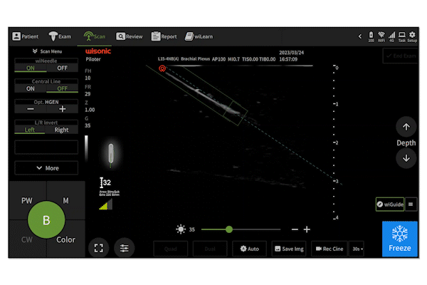 WiGuide Needle Biopsy System