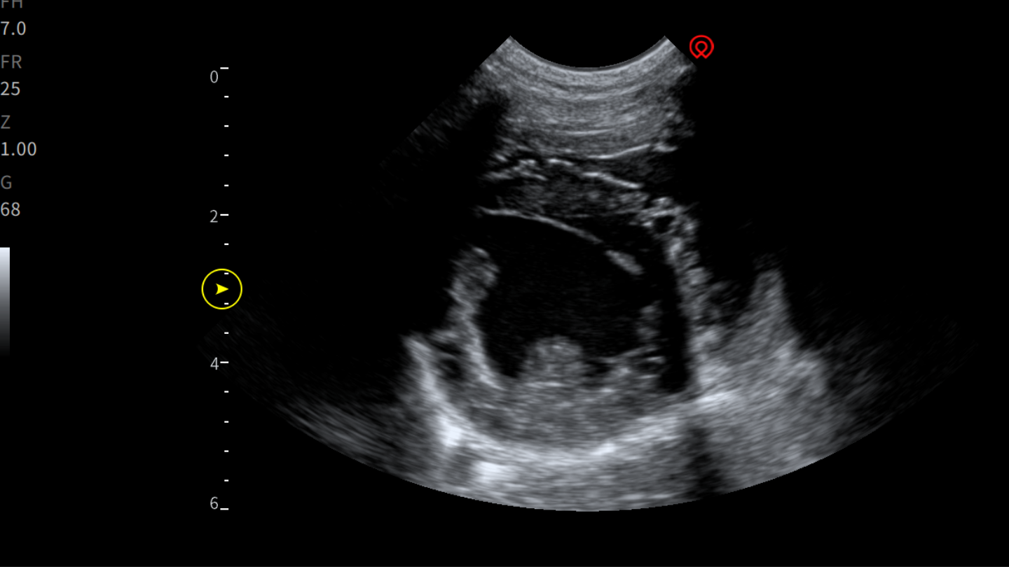Interactive Case Webinar: Even More General Cases