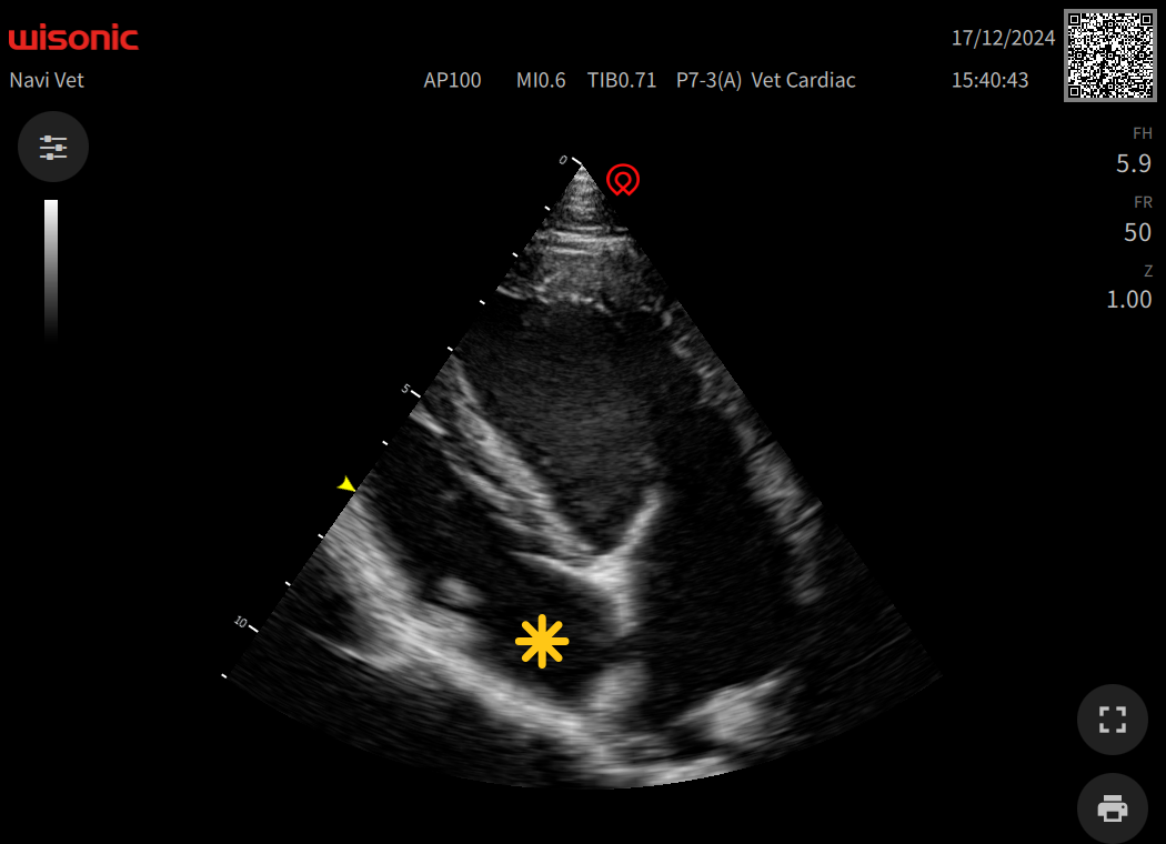 Interactive Case Webinar: Scary Things Caught Through Ultrasound