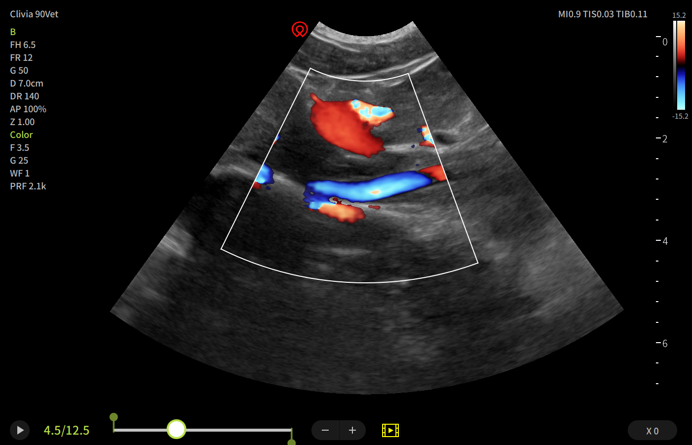 Interactive Case Webinar: Doppler Basics