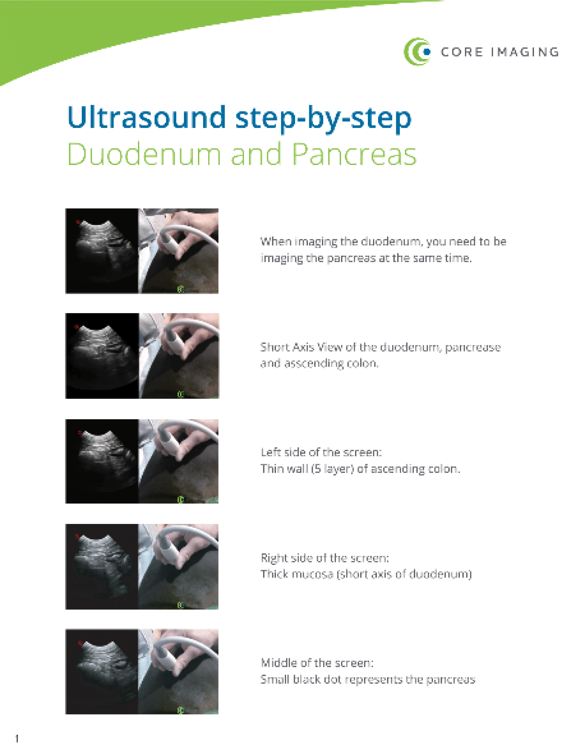 Step-by-Step Ultrasound Guide: Duodenum and Pancreas