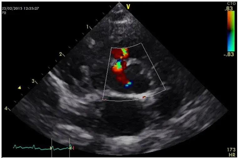 Interactive Case Webinar: Doppler Principles Part 2