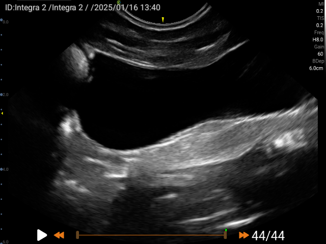 Interactive Case Webinar: Interesting Ultrasound Cases