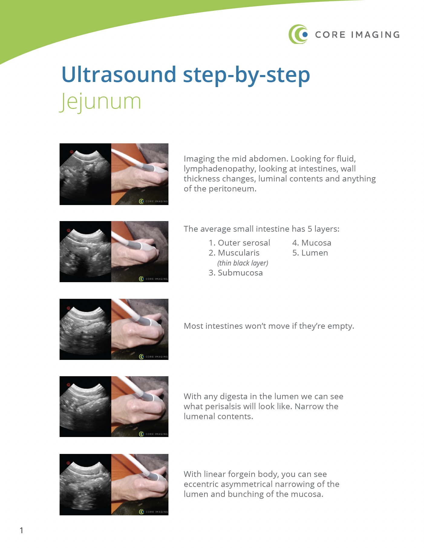 Step-by-Step Ultrasound Guide: Jejunum