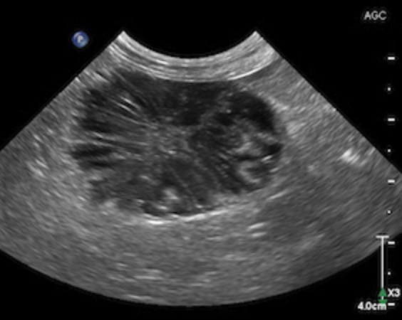 Interactive Case Webinar: Echocardiogram Cases